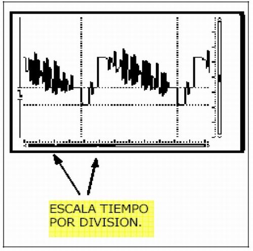 scope15